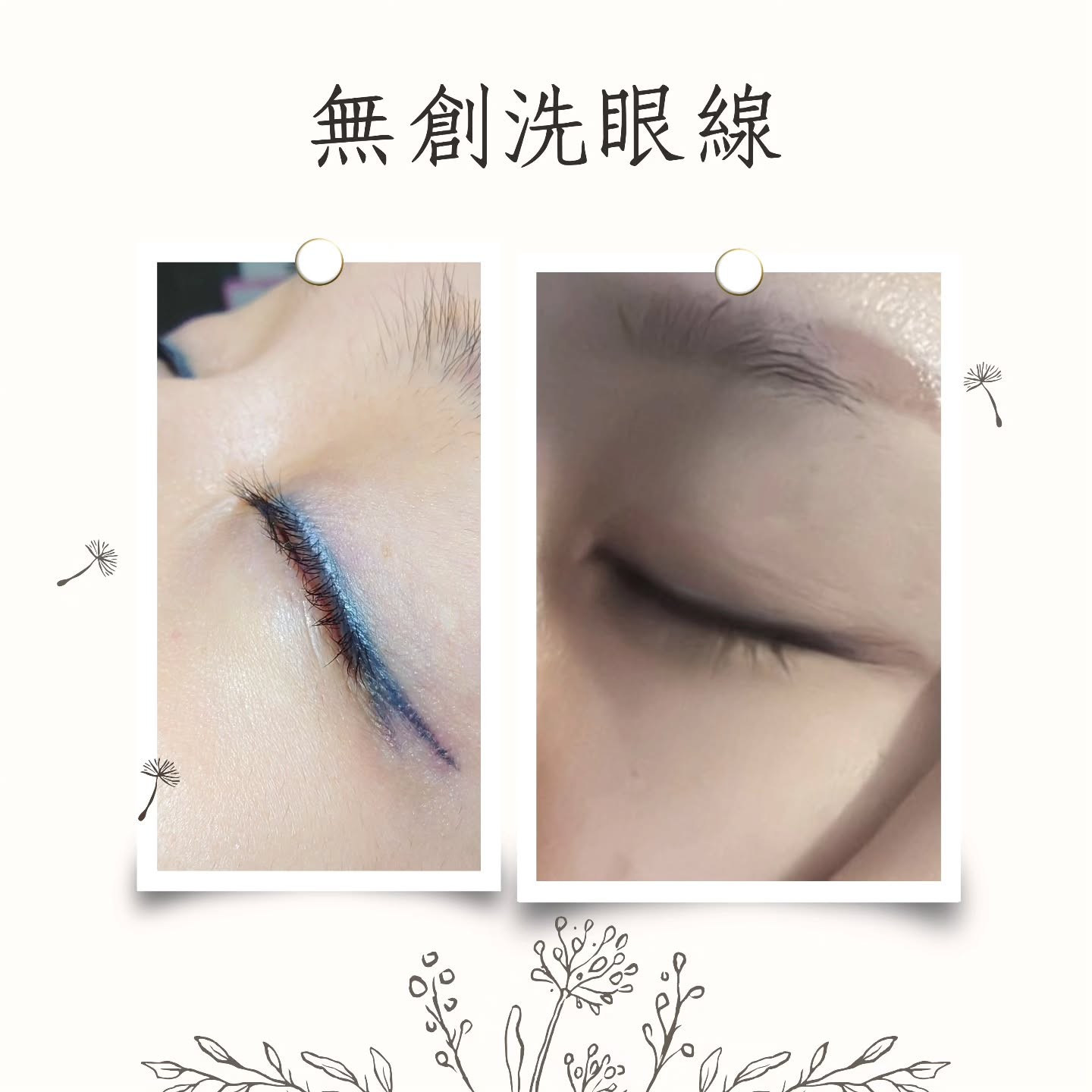 無創洗眼線