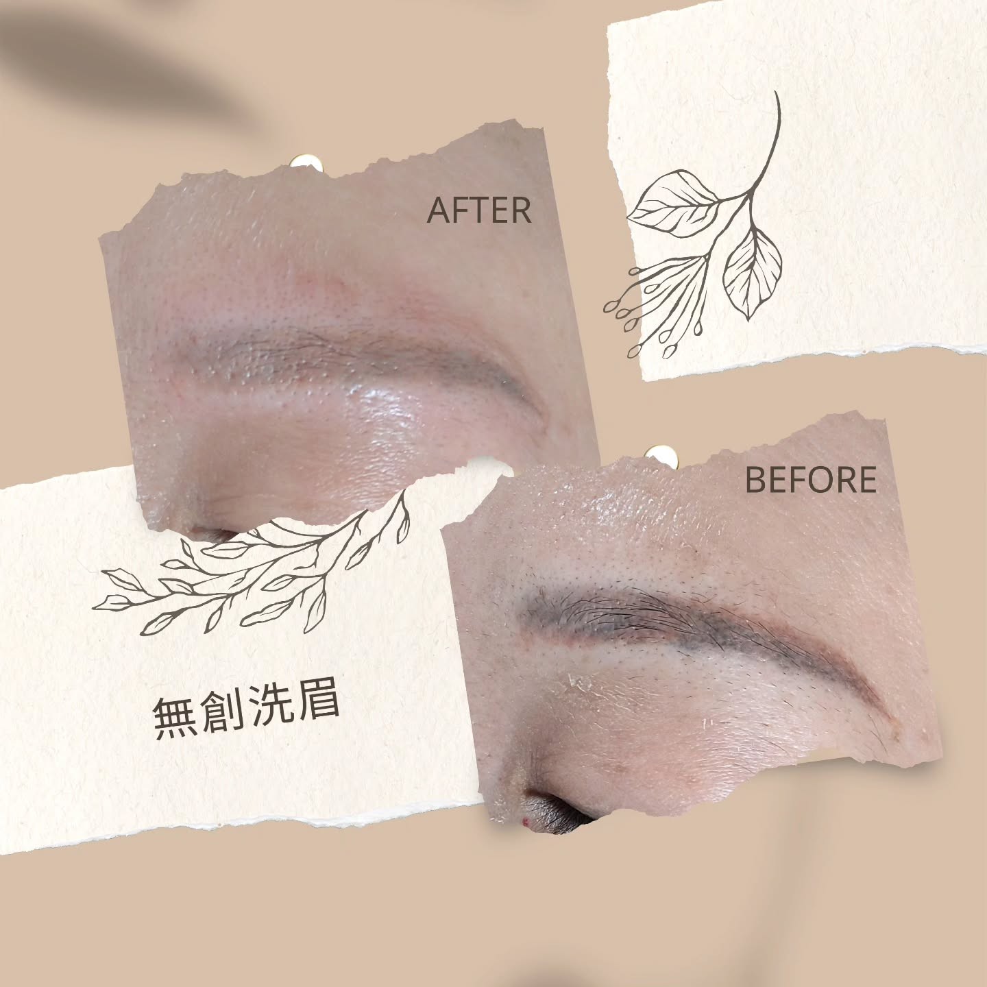 無創洗眉